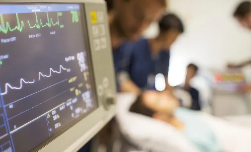 Heart rate monitor, patient and doctors in background in intensive care unit