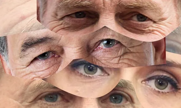 eyesleader