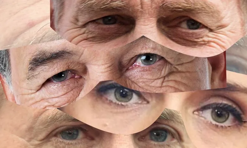 eyesleader