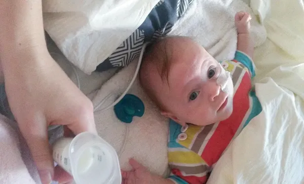 Tube feeding Ada at home, about 6 months old