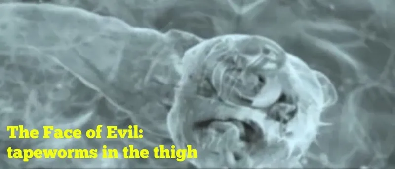 Tapeworm