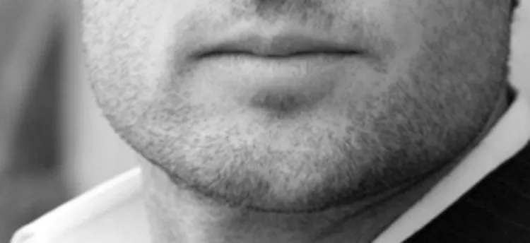 chin