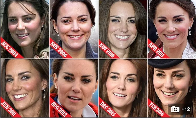 kate brow