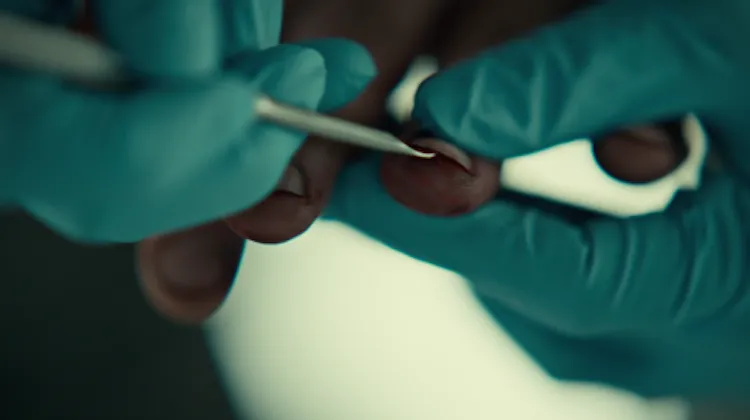 Hannibal Nail