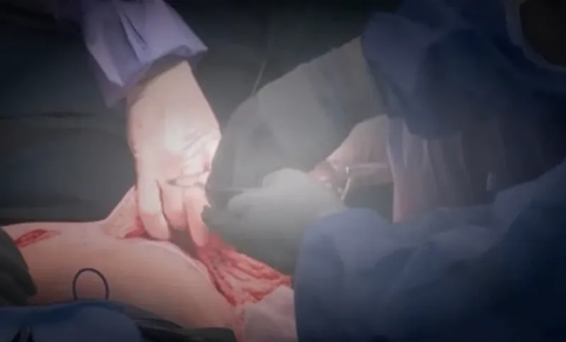 Still image from Beauty and the Beach (image: screengrab)