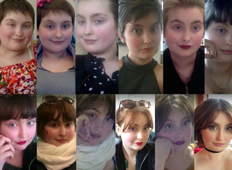Eva has been photographing herself every month of her treatment.