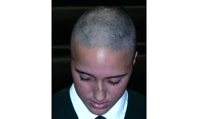 The author as a teenager with shaved head and clean eyebrows on display