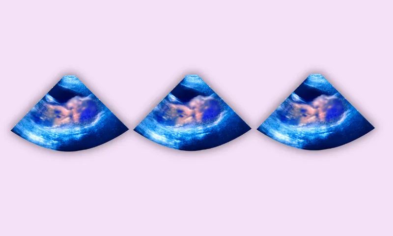 pink background with three blue and pink ultrasound images in the middle showing a baby in a womb but the baby is blurred